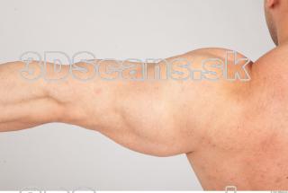 Arm texture of Gene 0002